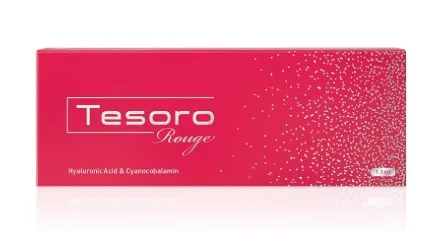 Tesoro Rouge